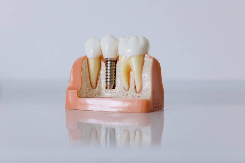 Cosmetic Prosthetics