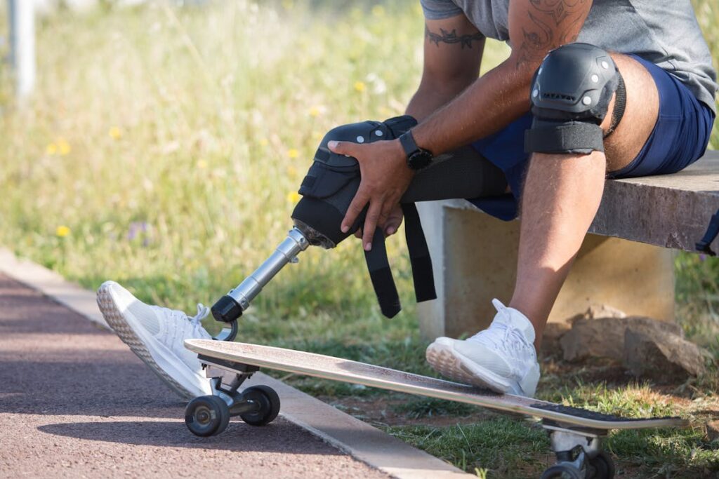 For veterans and individuals who have lost limbs due to trauma, rehabilitation is not only a physical journey but also a deeply emotional one.