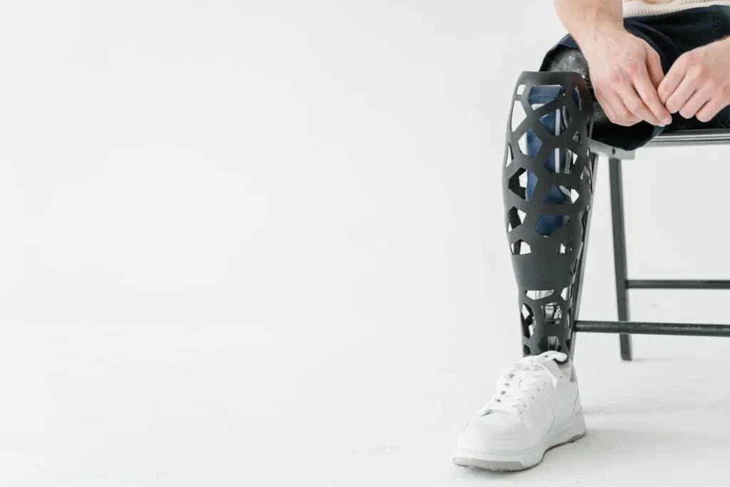 Recovering from an amputation is not just about physical rehabilitation—it is also an emotional journey. Many amputees struggle with feelings of loss, frustration, and anxiety as they adjust to life with a prosthetic limb.