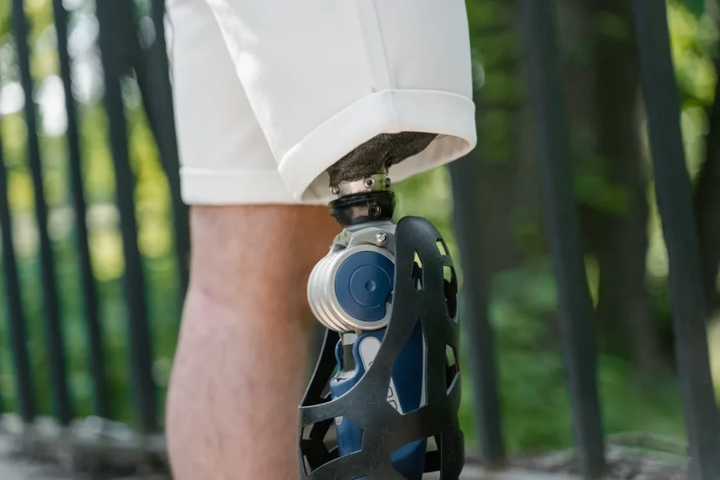 Virtual reality is still evolving, but it is already making a significant impact in the field of amputee rehabilitation.