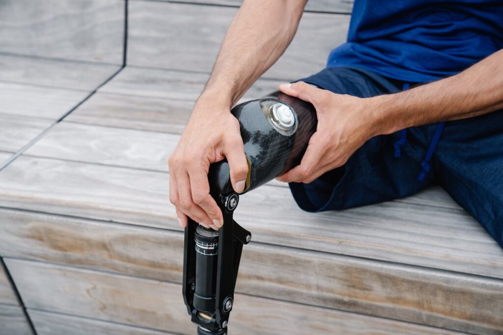 Avoid Overexerting Your Prosthetic