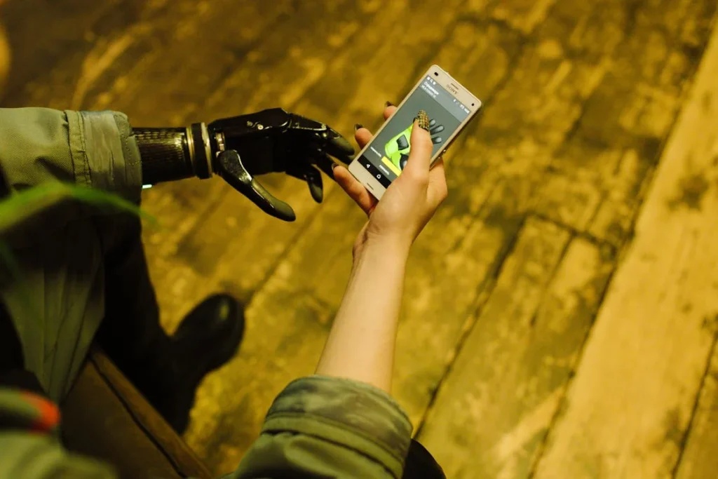 Adapting to an upper limb prosthetic is not just a physical journey—it is also an emotional one. Many people experience a mix of emotions, from excitement and hope to frustration and self-consciousness. Learning to use a prosthetic hand takes time, and for some, the psychological hurdles can be just as challenging as the physical ones.
