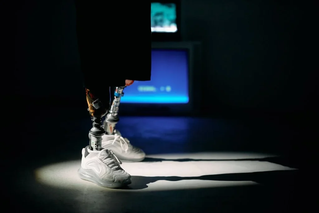 One of the biggest challenges in prosthetic care is cost. Traditional prosthetics, especially for complex cases like partial foot and hemipelvectomy amputations, can be expensive due to the materials, labor, and customization required. Many individuals either struggle to afford high-quality prosthetics or face long waiting times for adjustments and repairs. 3D printing is changing this by making prosthetics more affordable, accessible, and easier to modify as needed.