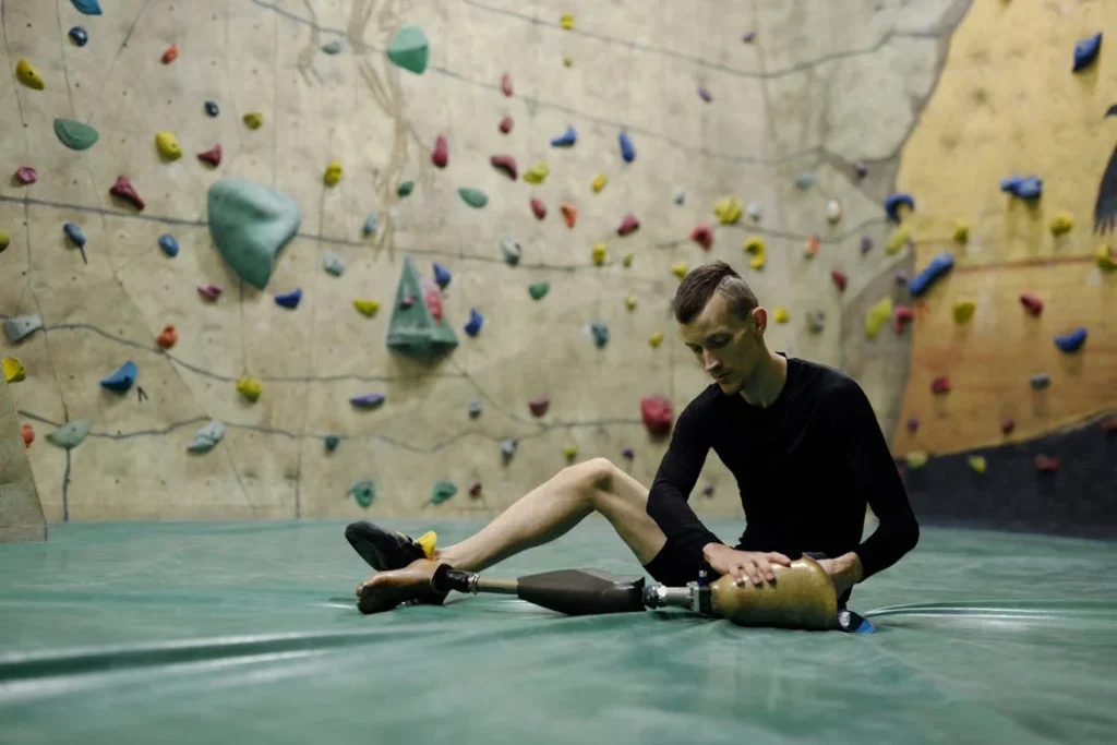 Walking on smooth, even ground is one thing, but real life involves all kinds of terrains—sidewalks, slopes, stairs, and uneven paths. One of the biggest concerns for individuals adapting to a hemipelvectomy prosthetic is learning how to navigate these everyday surfaces safely and confidently.