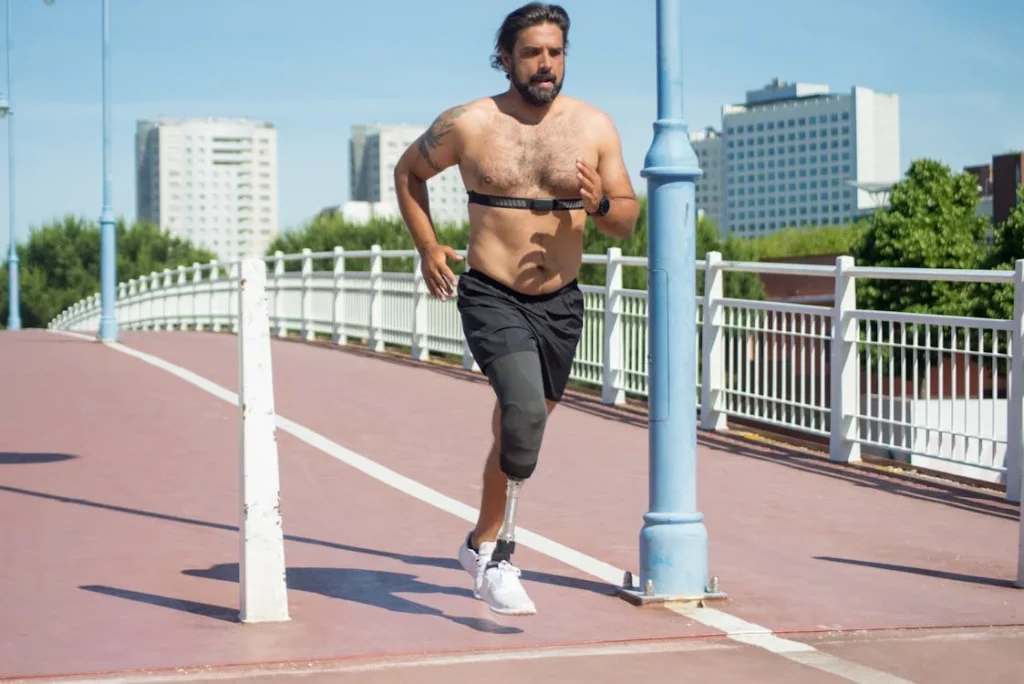 Hemipelvectomy is one of the most complex types of amputations, requiring highly specialized prosthetic solutions. Unlike below-the-knee or above-the-knee amputations, hemipelvectomy removes not just the leg but also part of the pelvis, making balance and mobility more challenging. In the past, prosthetic options for hemipelvectomy patients were bulky, uncomfortable, and often difficult to use for long periods. However, modern advancements are transforming these prosthetics into lightweight, functional, and more natural-feeling solutions.