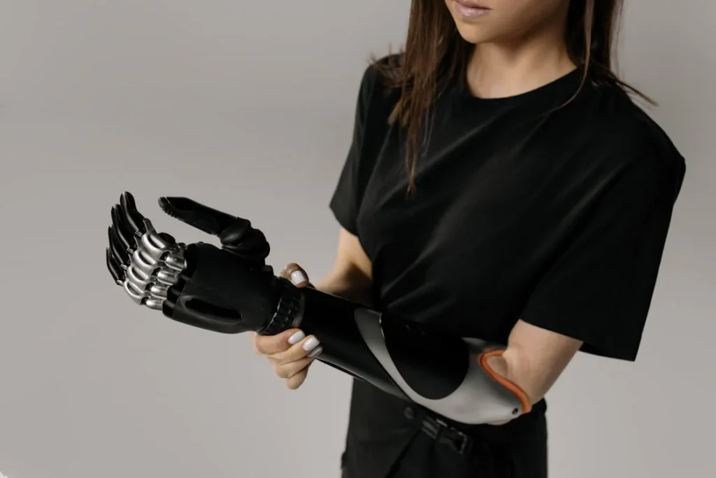 The cost of an upper limb prosthetic goes beyond the initial purchase. Many users don’t realize that maintenance, repairs, training, and replacements all contribute to the total cost over time. Understanding these hidden costs can help you plan your budget and avoid unexpected expenses.