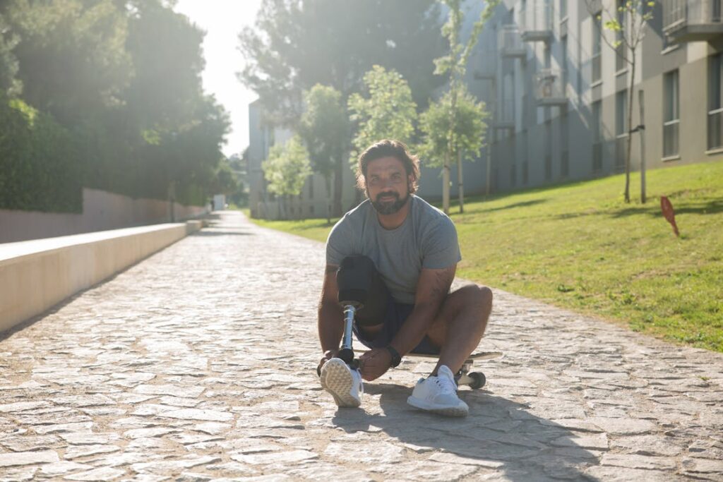 A well-designed socket does more than improve mobility—it enhances overall quality of life. Hemipelvectomy amputees face daily challenges that go beyond walking, including sitting comfortably, wearing different types of clothing, and engaging in physical activities. A custom socket ensures that these everyday experiences are as natural and effortless as possible.