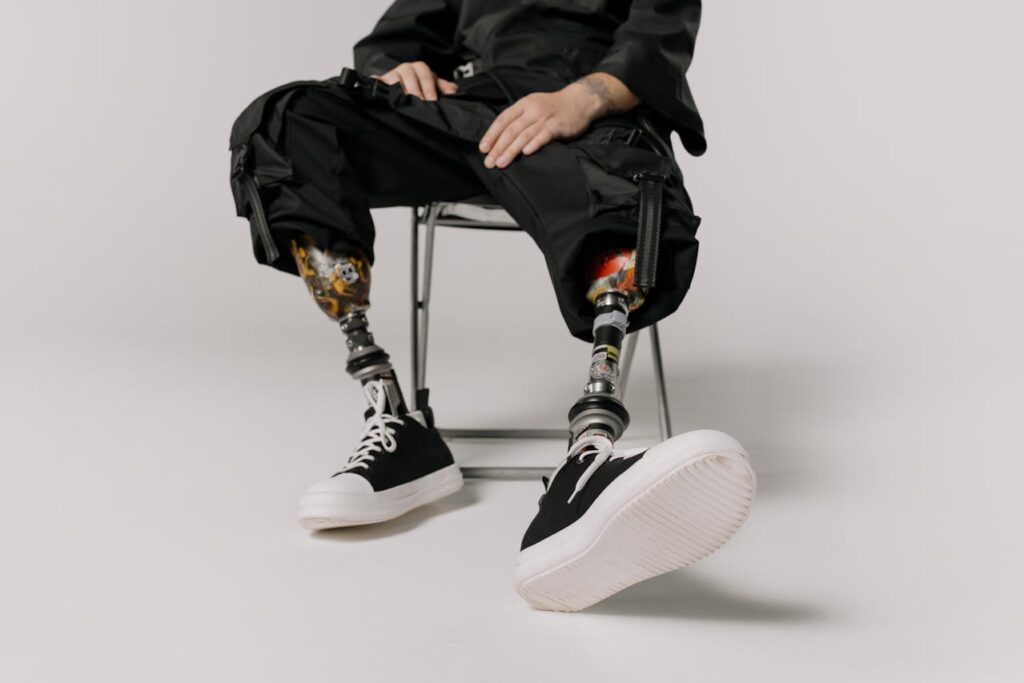Suspension systems in above-knee prosthetics have a more complex job.