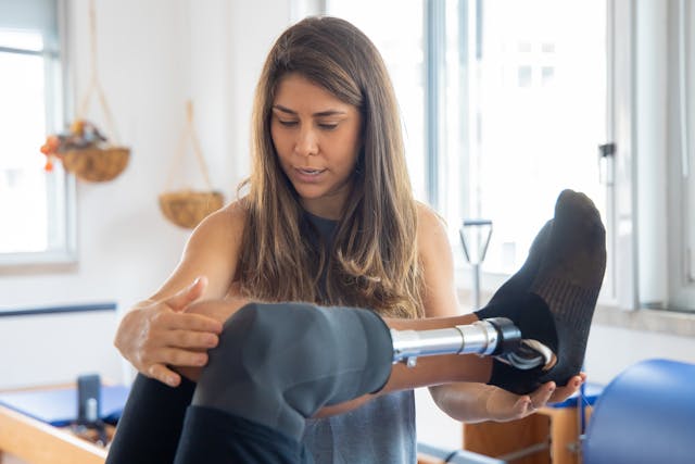 Getting a prosthetic hand is just the first step—learning how to use it effectively requires training and rehabilitation.