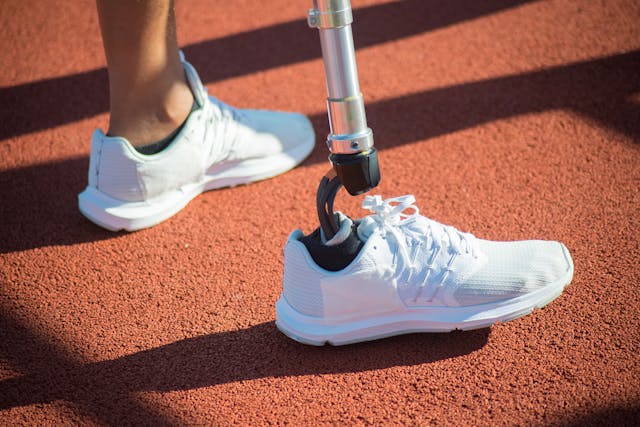 One factor that’s often overlooked in recovery is the complexity of the prosthetic itself.