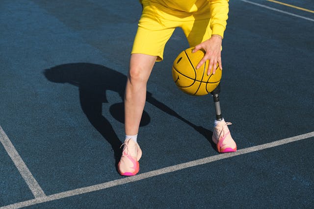 The way a prosthetic socket stays attached to the limb can significantly impact comfort and usability.