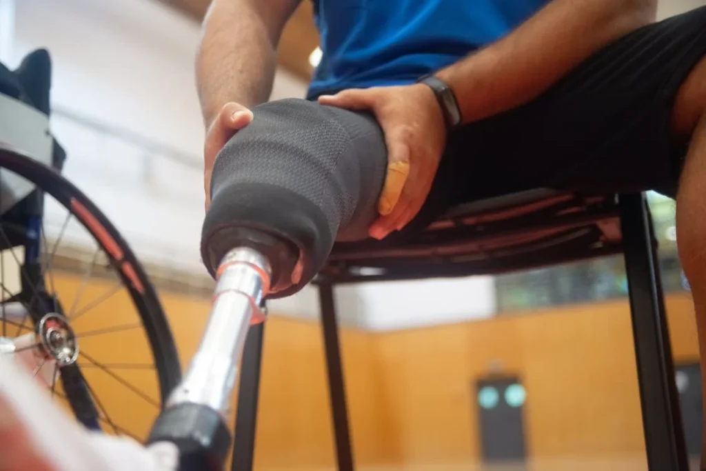 Once the initial healing period is over and the residual limb is stable, the focus of physical therapy begins to shift. Now, it’s about preparing the body for prosthetic fitting—and making sure the person is ready for the new kind of movement that’s coming next.