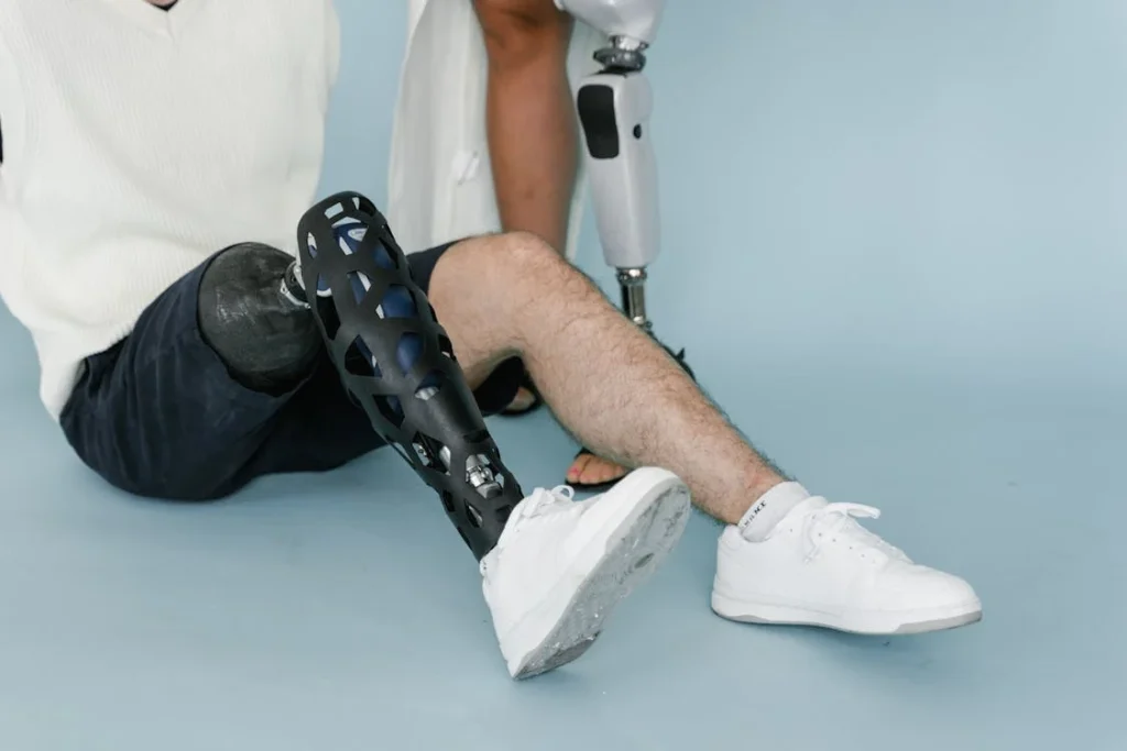 Healing after limb loss doesn’t stop with the body. The emotional part of recovery often lasts longer, and it shapes how people adapt to life with a prosthetic.