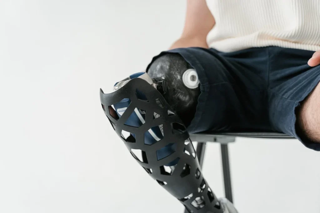 When a person receives a prosthetic, one of the first things they notice is how it feels when worn. That first impression matters more than most people realize. If the prosthetic feels snug but supportive, soft in the right places, and balanced while standing or walking, it builds trust. The user feels encouraged to wear it more, to move more, and to start rebuilding their daily life.