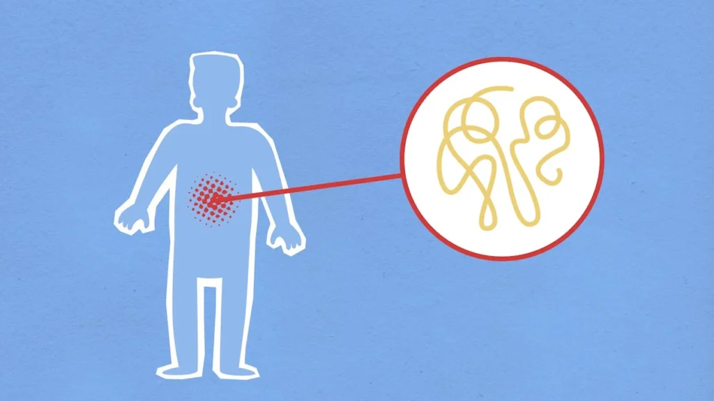 Before making any choice, it’s important to understand what’s happening inside the body. Cancer in the limbs usually begins in the bones or soft tissues like muscles, nerves, or fat.