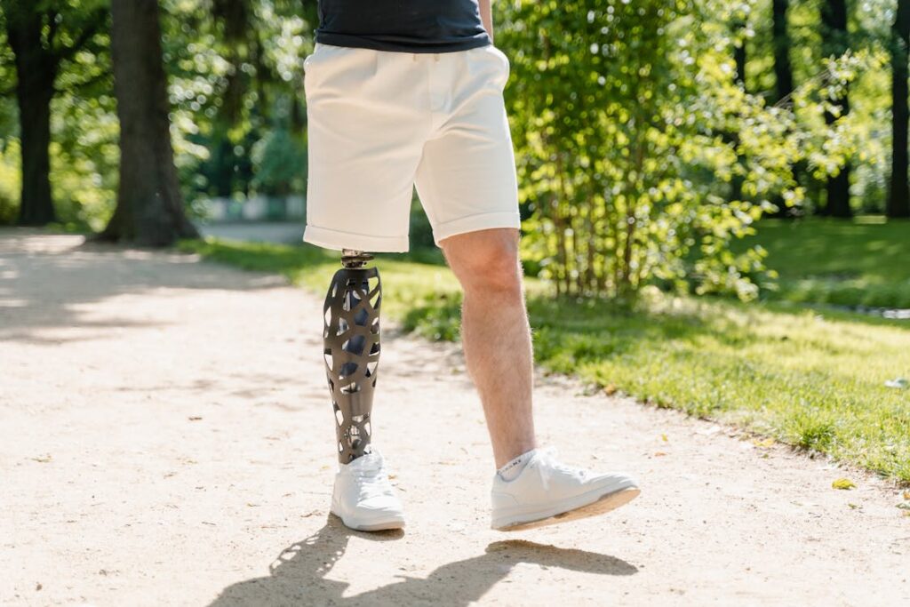 Getting the right fit for your prosthetic isn’t a one-time event. It’s a journey. Just like your body keeps evolving, so should the way your prosthesis fits, feels, and functions. When you start to notice discomfort, it’s easy to feel overwhelmed or unsure of what to do next. But the good news is, there’s always something that can be done. Small steps can make a big difference, and the path to a better fit starts with awareness, action, and open communication.
