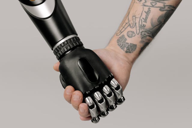 The main difference between a dynamic orthosis and a prosthetic arm lies in how they work and who they’re for.