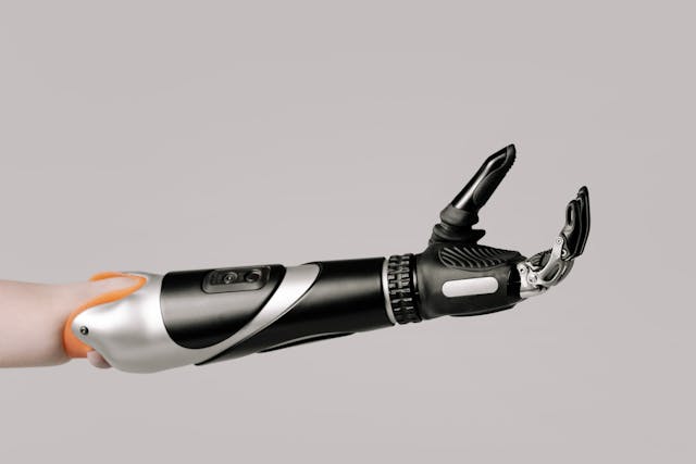 A myoelectric prosthetic arm uses muscle signals to control its movements.