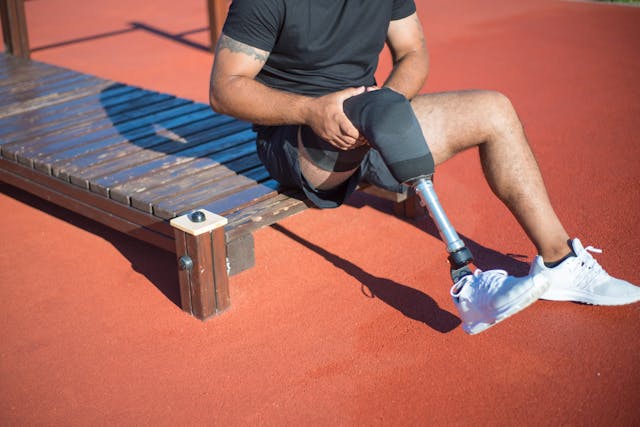 Limb differences can appear in many forms. Some may involve a missing part of a limb, while others may affect the shape, length, or position of the limb.