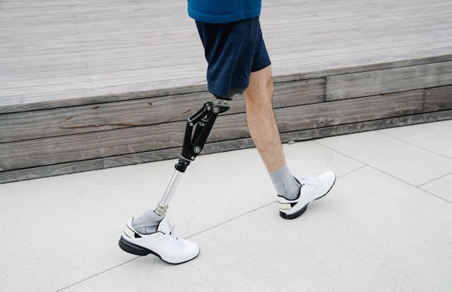 As children grow, some may benefit from more advanced prosthetics that allow them to move fingers or grip objects using muscle signals.