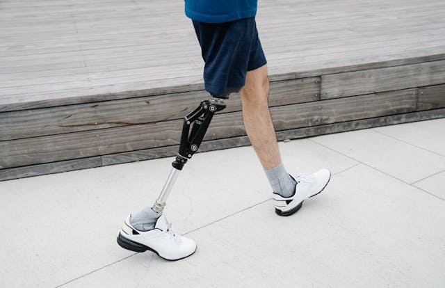 Are bionic limbs a practical solution for children with congenital limb loss? Discover the current reality, limitations, and exciting future potential