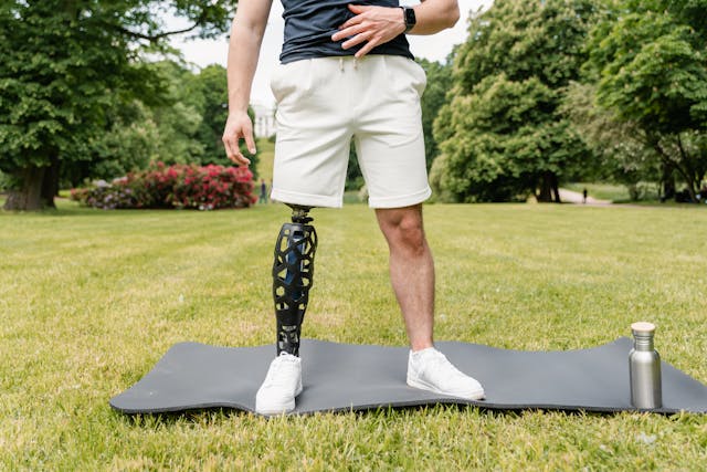 Early intervention plays a powerful role in helping children with congenital limb deficiencies grow and thrive.