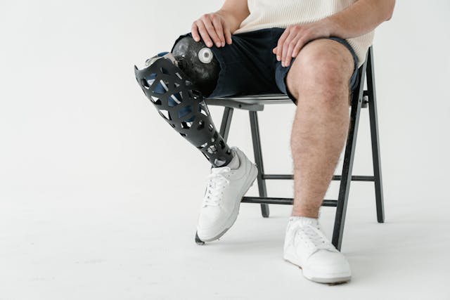 At the age of four, Aarav was introduced to his first prosthetic arm.