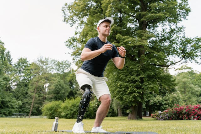 Fitting a prosthetic isn’t a one-day visit. It takes multiple fittings