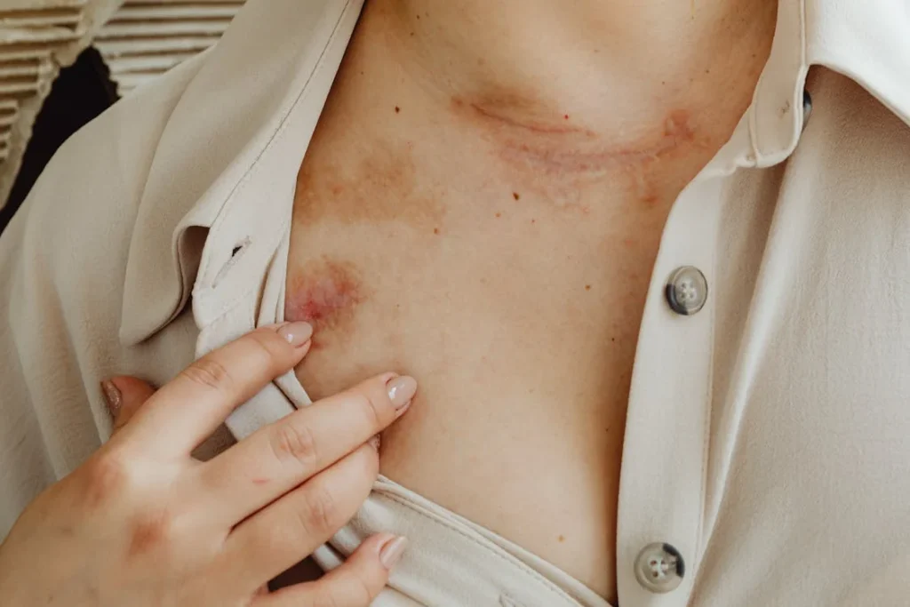 Scar tissue forms as the body’s natural way of healing after an injury or surgery. When the skin is cut during amputation surgery, your body responds by creating new tissue to close the wound and protect the area.