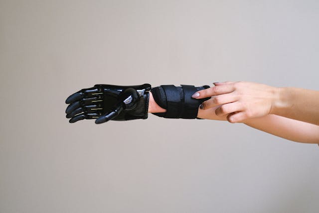 Nisha was born with a limb difference that made holding a pen difficult.