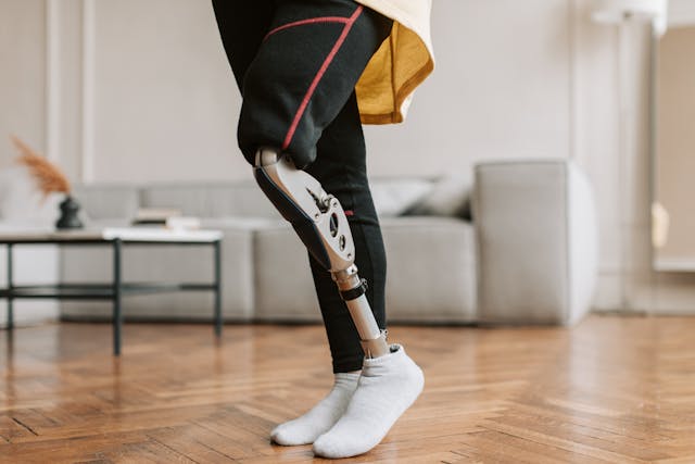 Another major shift in 2024 is in how prosthetics are made.