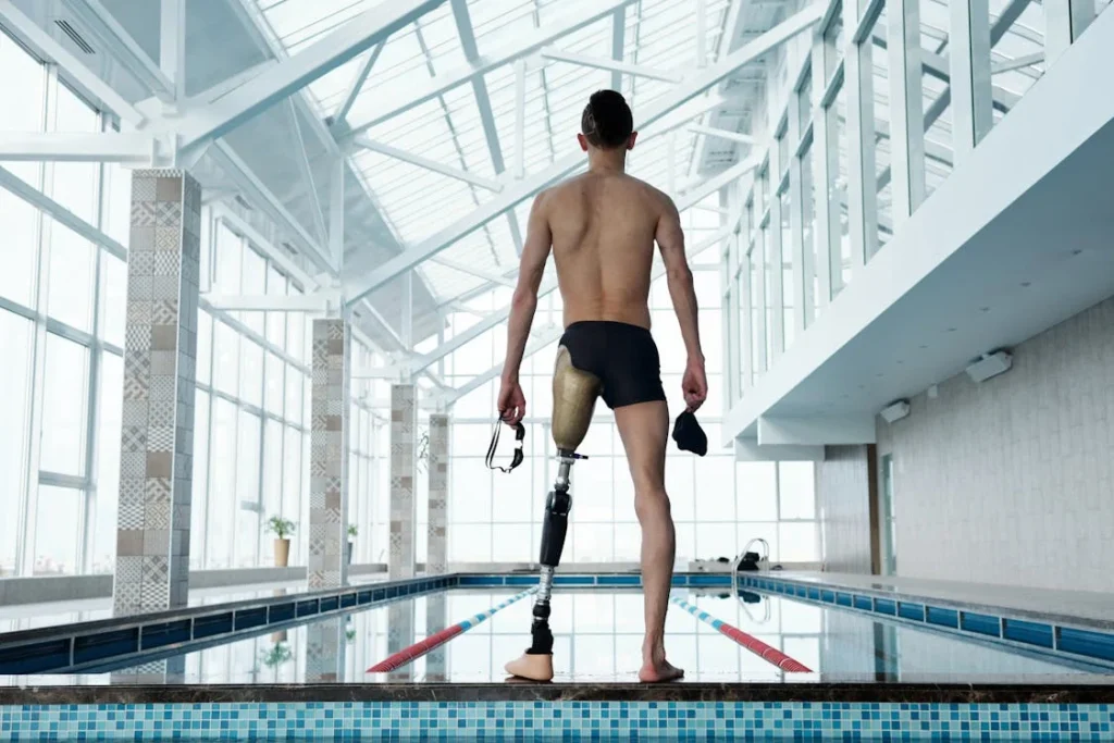 When someone experiences limb loss, the emotional strain is not limited to the individual alone. Family members, spouses, and caregivers are often deeply affected. They witness their loved one’s pain, confusion, and grief — often while struggling with their own fears and responsibilities. The emotional burden on caregivers is real, and if not addressed, it can strain relationships and even delay recovery.