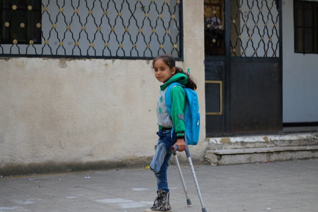 Losing a limb is deeply emotional.