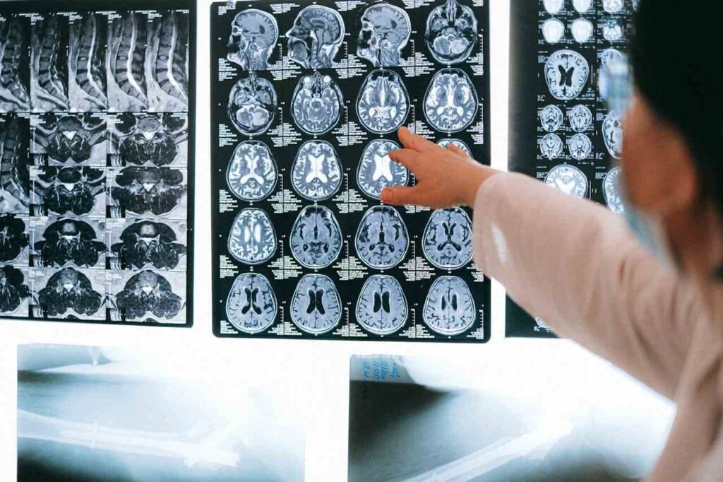 Inside your brain is a special area called the motor cortex